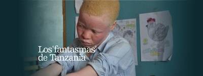 El drama de los albinos en Tanzania