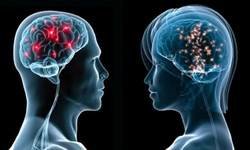 El cerebro del hombre y el de la mujer son diferentes