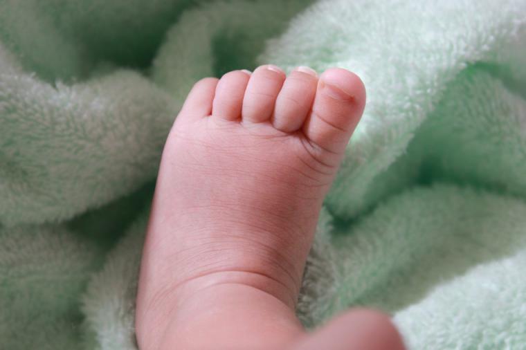 Infierno al nacer: Amputan la pierna de un bebé 
