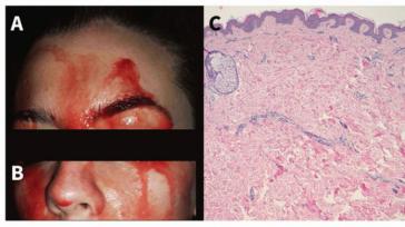 Los médicos estudian el inquietante caso de una joven que suda sangre por las manos y la cara