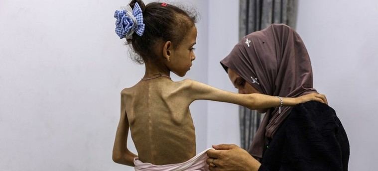 Crisis sin precedentes en Gaza: Más de 500.000 personas están a un paso de la inanición