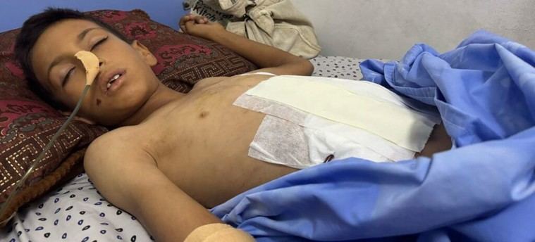 Crisis en Gaza: Hospitales colapsan y surgen enfermedades raras por la falta de recursos