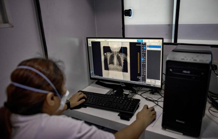 IA mejora la detección de tuberculosis en Manila, Filipinas