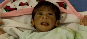 Datos impactantes: Más de 1.000 muertos intentando alimentarse a la desesperada en Gaza