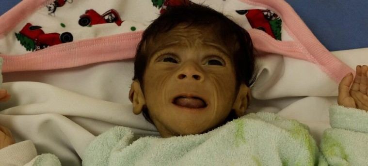 Datos impactantes: Más de 1.000 muertos intentando alimentarse a la desesperada en Gaza
